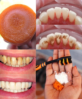 🥕 Brighten Your Smile Naturally with… Carrot Tops? Yes, Really!